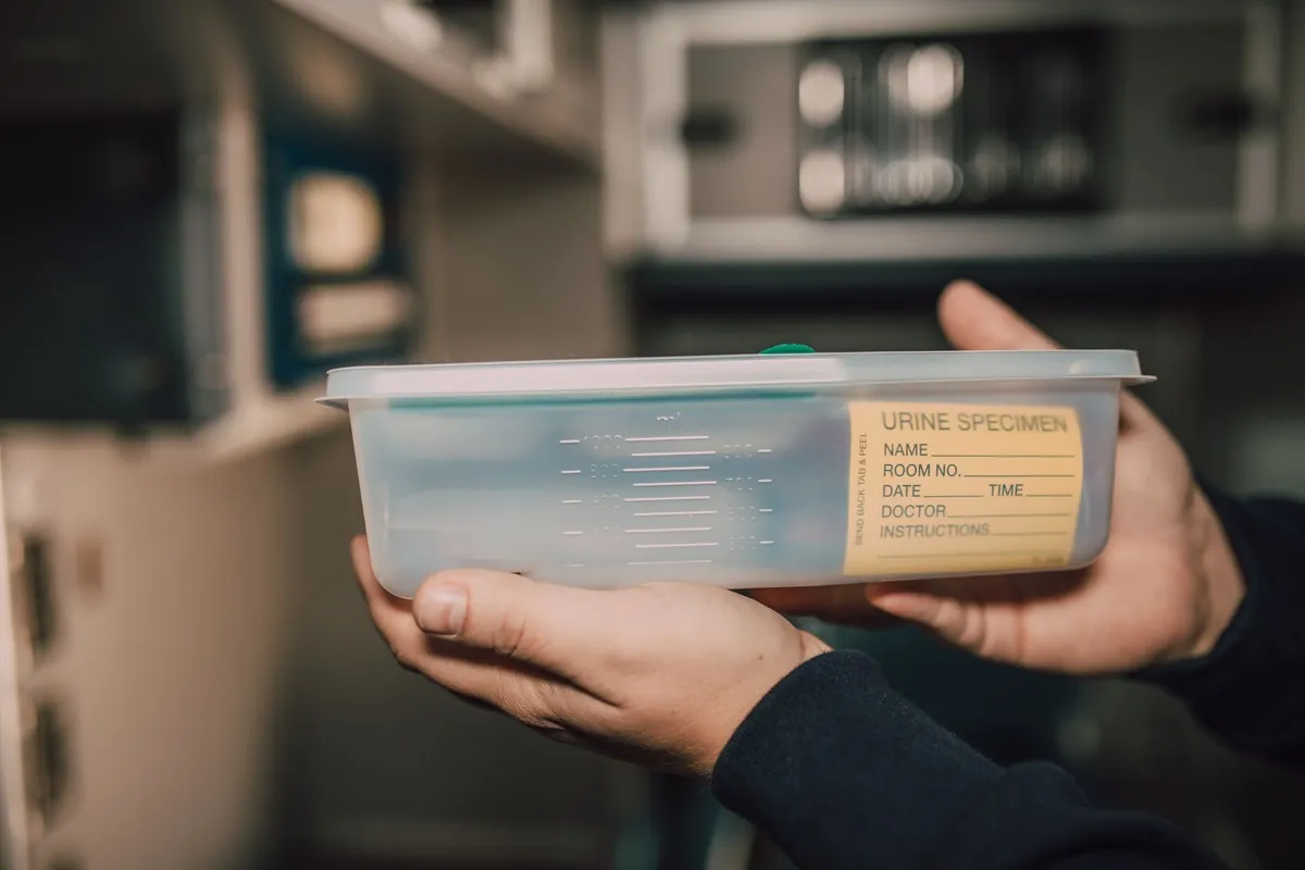 Tangan memegang wadah plastik bening bertuliskan 'Urine Specimen' (spesimen urine) di sebuah klinik